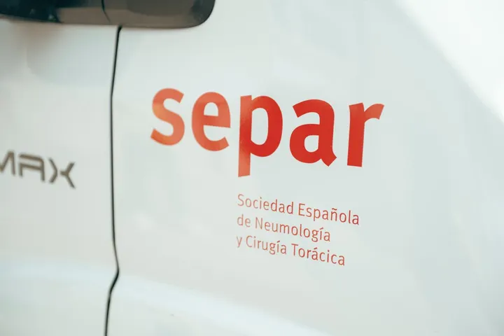 Foto del blog